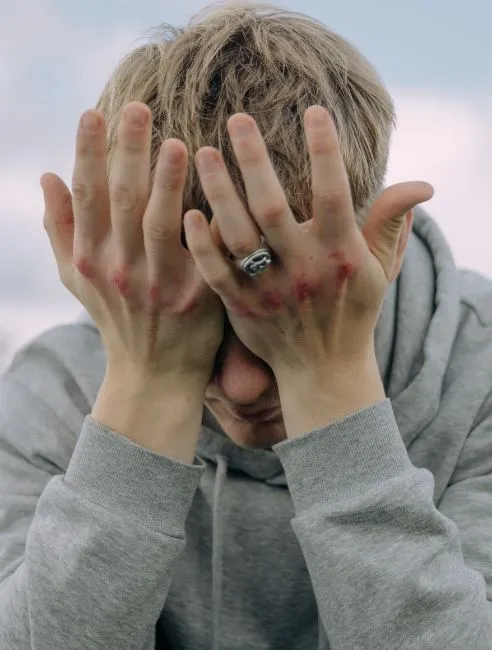 Optimove Migraines and Headaches