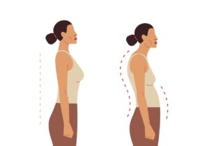 Optimove Aesthetics and Pilates: How Posture and Movement Influence Facial Appearance